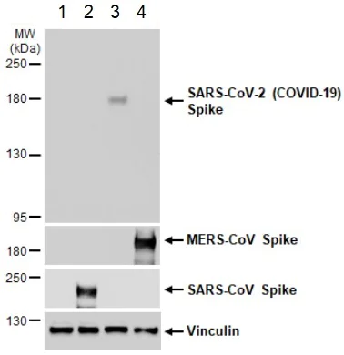 Western blot - Anti-SARS-CoV-2 Spike Glycoprotein S1 antibody [HL263] - BSA and Azide free (AB281310)