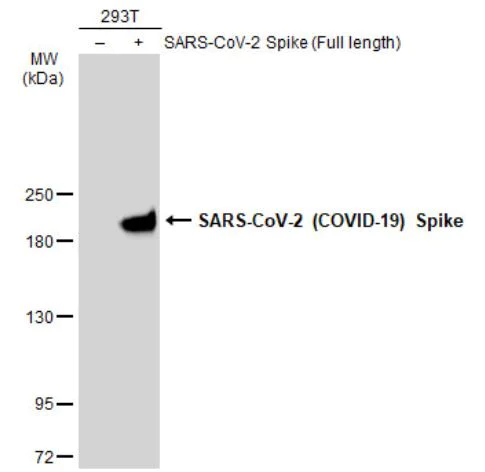 Western blot - Anti-SARS-CoV-2 Spike Glycoprotein S1 antibody [HL263] - BSA and Azide free (AB281310)