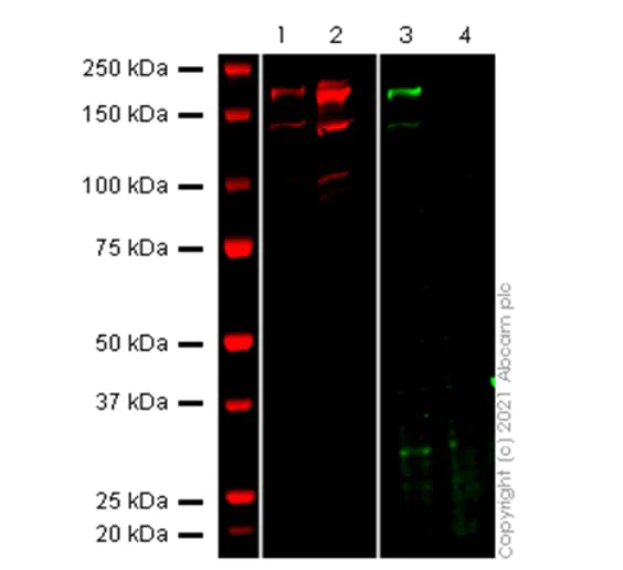 Western blot - Anti-SARS-CoV-2 Spike Glycoprotein S1 (RBD) antibody [EPR24852-174] - BSA and Azide free (AB283947)