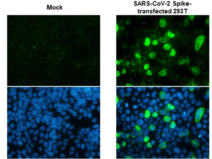 Immunocytochemistry/ Immunofluorescence - Anti-SARS-CoV-2 Spike Glycoprotein S2 antibody [HL237] - BSA and Azide free (AB281312)