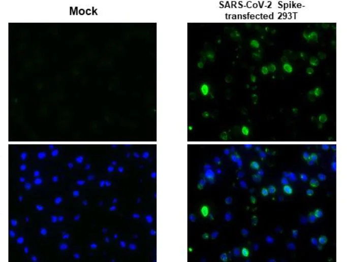 Immunohistochemistry (Formalin/PFA-fixed paraffin-embedded sections) - Anti-SARS-CoV-2 Spike Glycoprotein S2 antibody [HL237] - BSA and Azide free (AB281312)