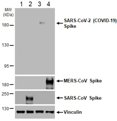 Western blot - Anti-SARS-CoV-2 Spike Glycoprotein S2 antibody [HL237] - BSA and Azide free (AB281312)
