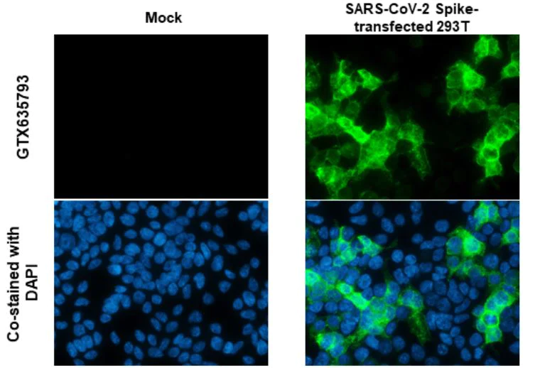 Immunocytochemistry/ Immunofluorescence - Anti-SARS-CoV-2 Spike RBD antibody [HL1004] - BSA and Azide free (AB281304)