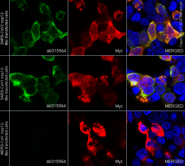 Immunocytochemistry/ Immunofluorescence - Anti-SARS-CoV2 nsp12 antibody [EPR24837-213] (ab315964), expandable thumbnail