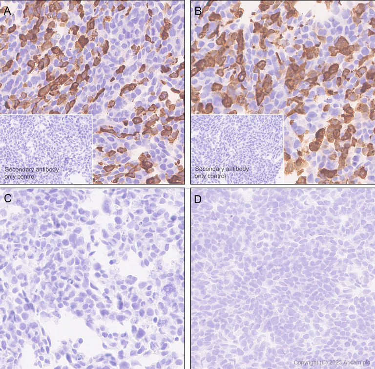 Immunohistochemistry (Formalin/PFA-fixed paraffin-embedded sections) - Anti-SARS-CoV2 nsp12 antibody [EPR24837-213] (AB315964)