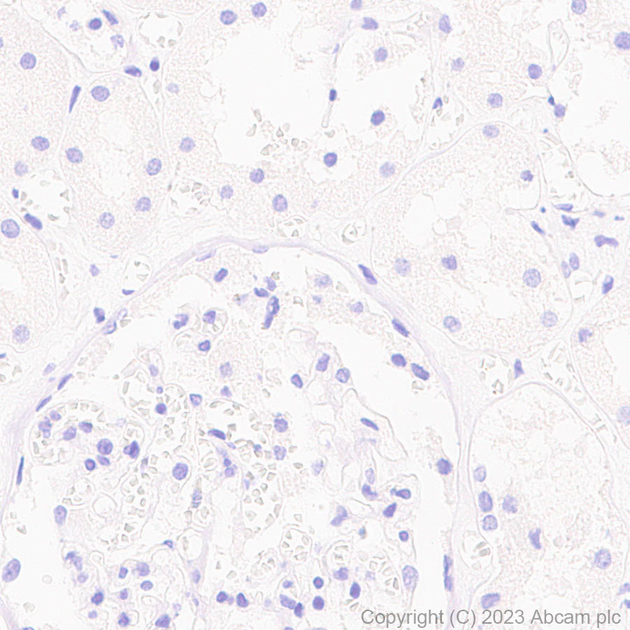 Immunohistochemistry (Formalin/PFA-fixed paraffin-embedded sections) - Anti-SARS-CoV2 nsp12 antibody [EPR24837-213] (AB315964), expandable thumbnail