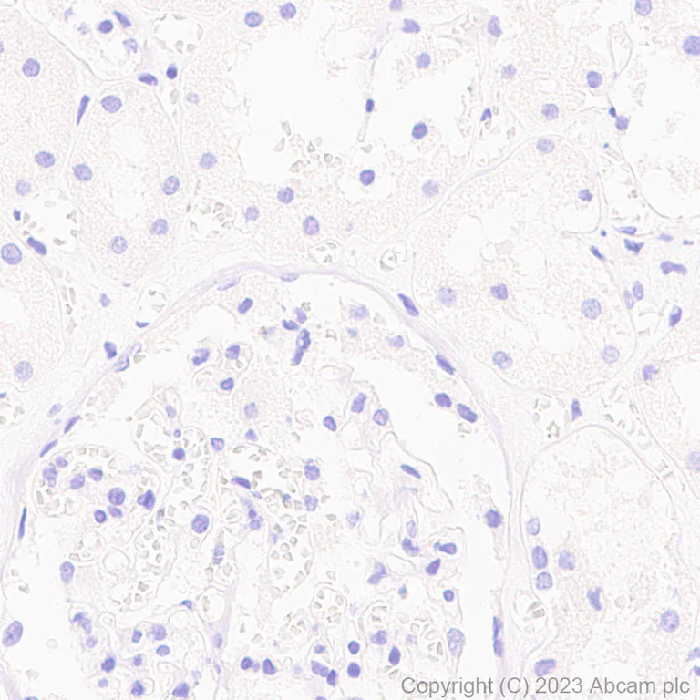 Immunohistochemistry (Formalin/PFA-fixed paraffin-embedded sections) - Anti-SARS-CoV2 nsp12 antibody [EPR24837-213] (AB315964)