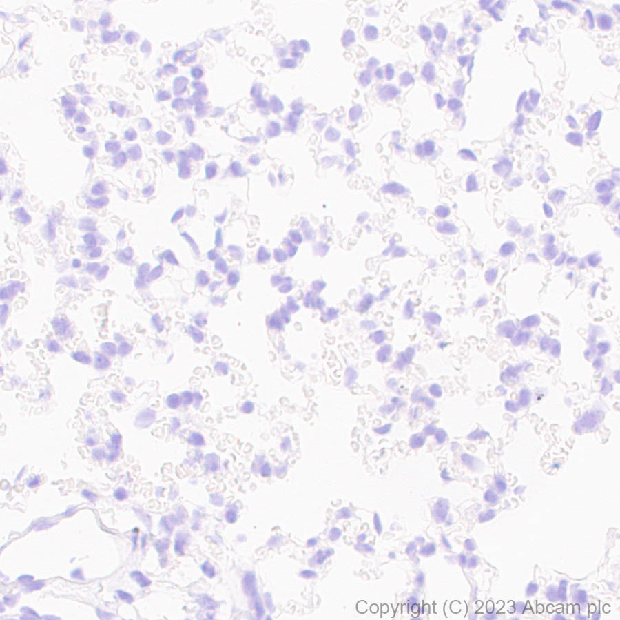 Immunohistochemistry (Formalin/PFA-fixed paraffin-embedded sections) - Anti-SARS-CoV2 nsp12 antibody [EPR24837-213] (AB315964), expandable thumbnail