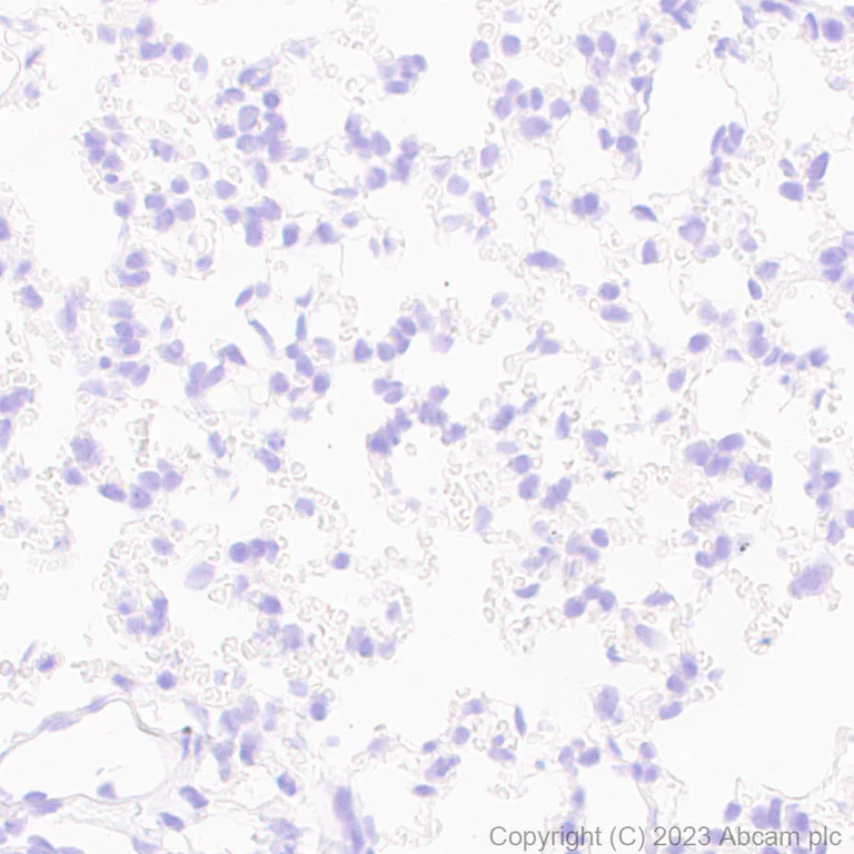 Immunohistochemistry (Formalin/PFA-fixed paraffin-embedded sections) - Anti-SARS-CoV2 nsp12 antibody [EPR24837-213] (AB315964)