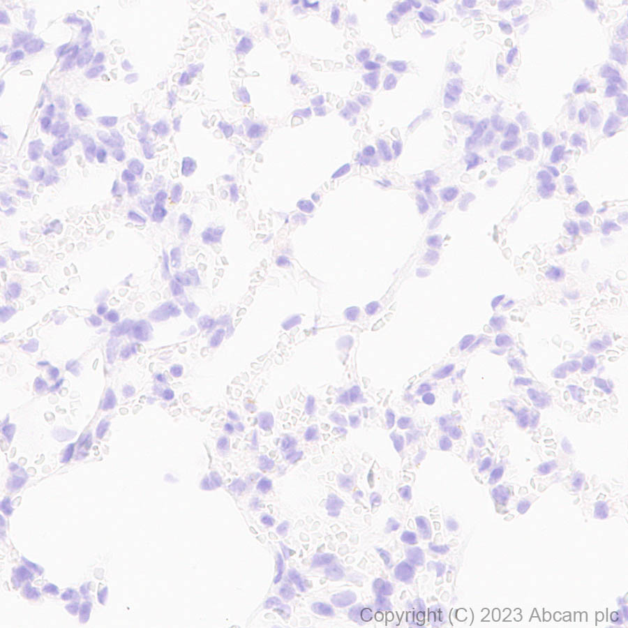 Immunohistochemistry (Formalin/PFA-fixed paraffin-embedded sections) - Anti-SARS-CoV2 nsp12 antibody [EPR24837-213] (AB315964), expandable thumbnail