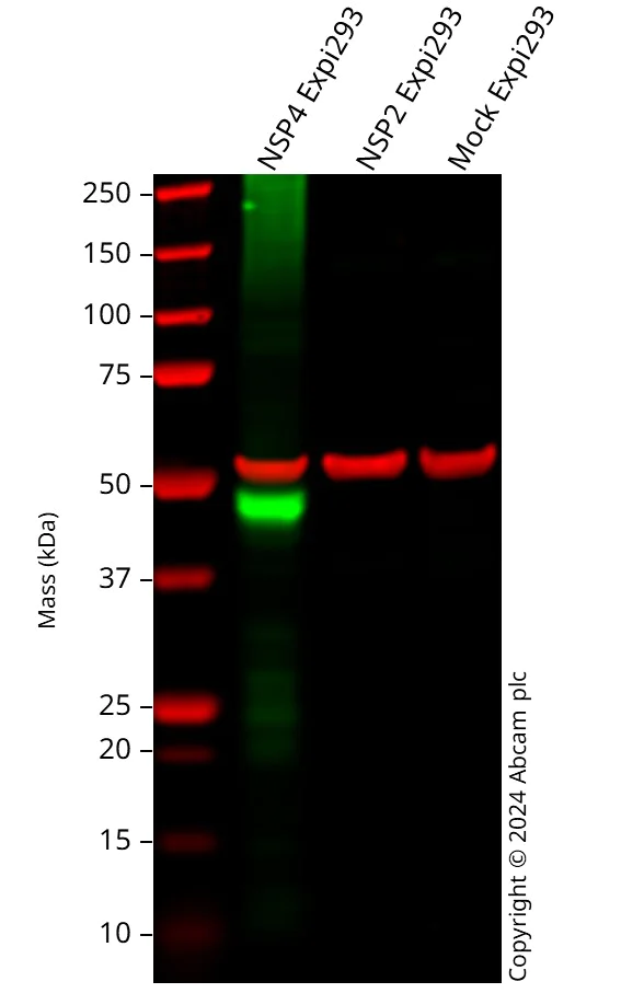 Western blot - Anti-SARS-CoV2 nsp4 antibody [EPR24843-87] (AB320090)