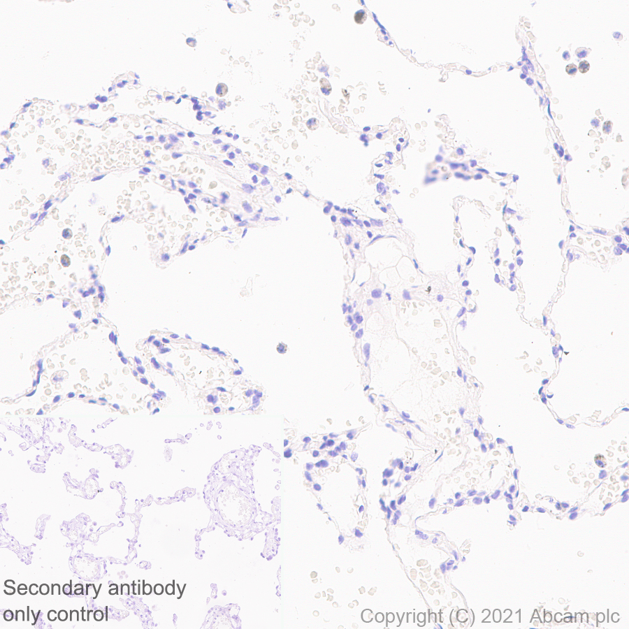 Immunohistochemistry (Formalin/PFA-fixed paraffin-embedded sections) - Anti-SARS-CoV2 orf3a antibody [EPR24848-9] (AB280953), expandable thumbnail