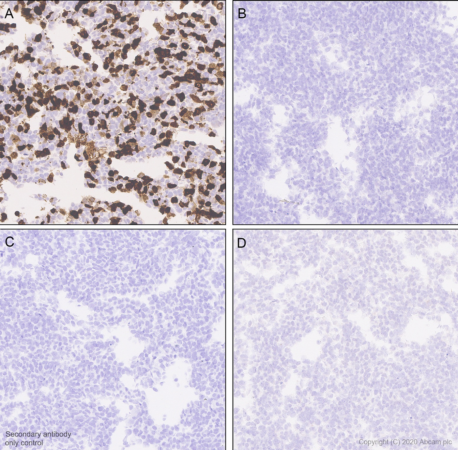 Immunohistochemistry (Formalin/PFA-fixed paraffin-embedded sections) - Anti-SARS-CoV2 orf3a antibody [EPR24848-9] (AB280953), expandable thumbnail