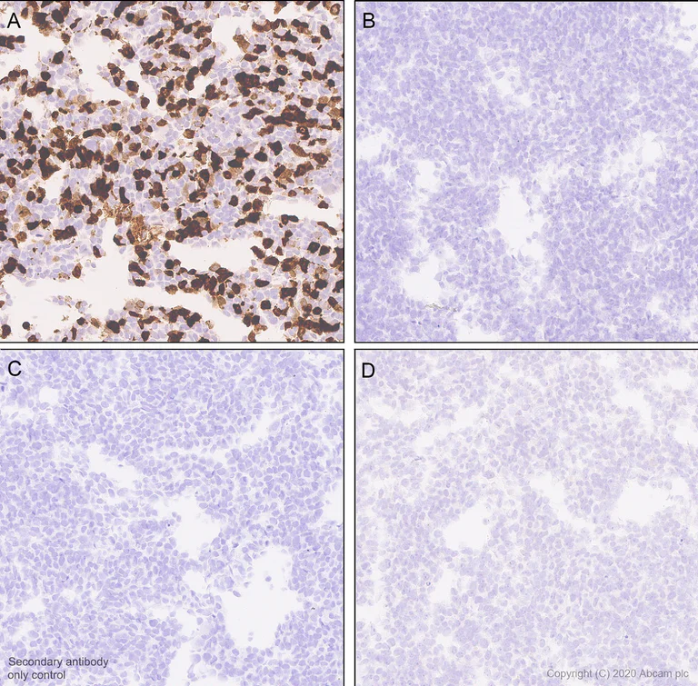 Immunohistochemistry (Formalin/PFA-fixed paraffin-embedded sections) - Anti-SARS-CoV2 orf3a antibody [EPR24848-9] (AB280953)