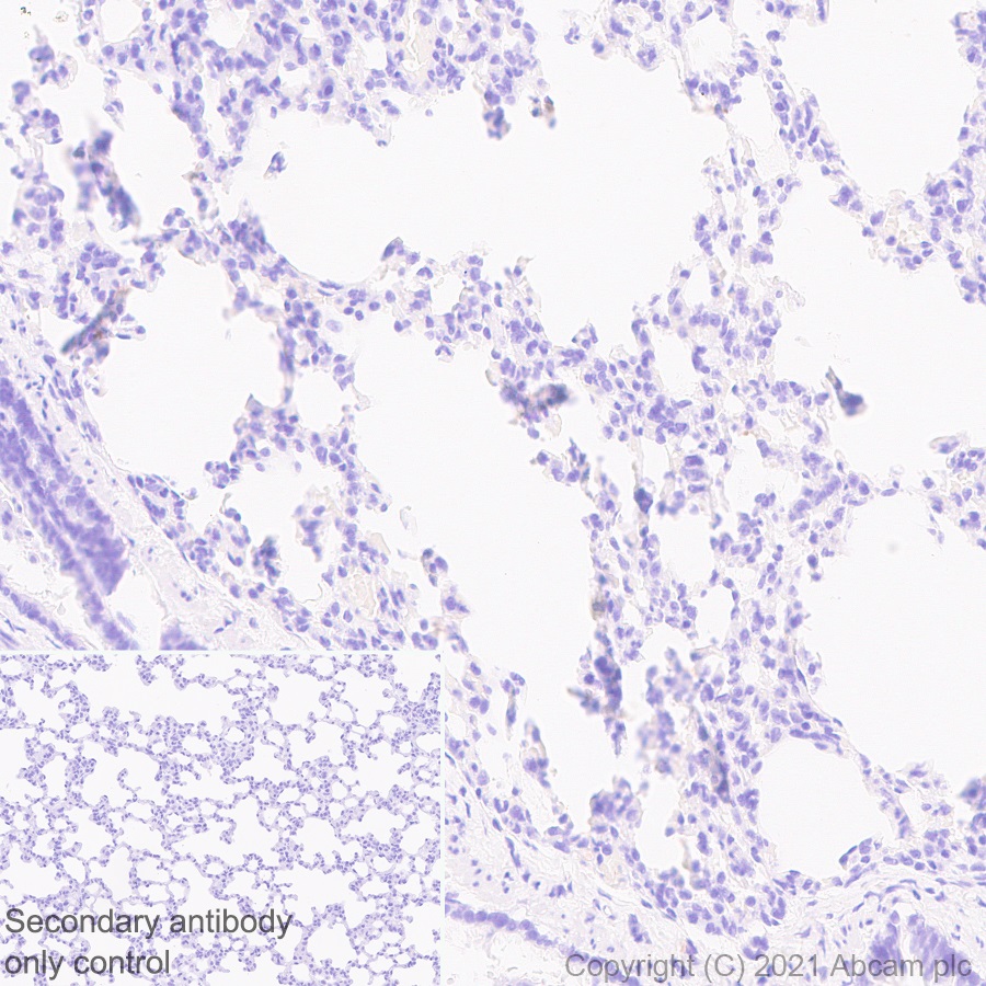 Immunohistochemistry (Formalin/PFA-fixed paraffin-embedded sections) - Anti-SARS-CoV2 orf3a antibody [EPR24848-9] (ab280953), expandable thumbnail