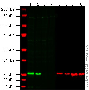 Western blot - Anti-SARS-CoV2 orf3a antibody [EPR24848-9] (AB280953), expandable thumbnail