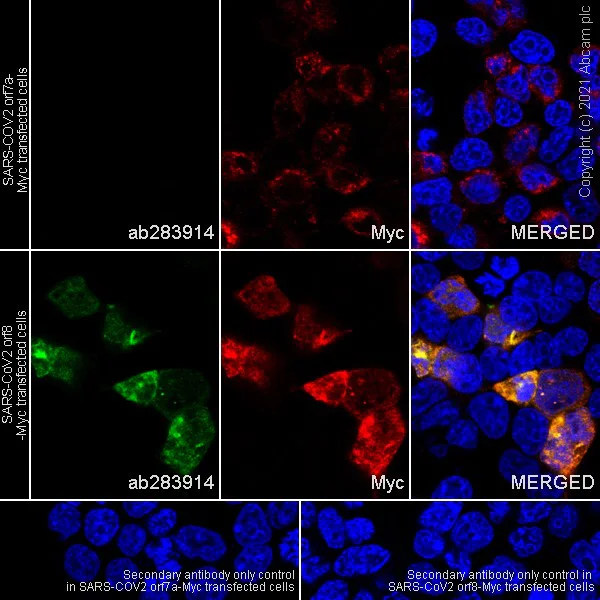 Immunocytochemistry/ Immunofluorescence - Anti-SARS-CoV2 orf8 antibody [EPR24851-65] - BSA and Azide free (AB284042)