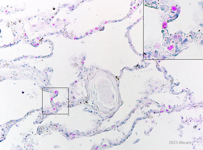 Immunohistochemistry (Formalin/PFA-fixed paraffin-embedded sections) - Anti-SARS-CoV2 orf8 antibody [EPR24851-65] - BSA and Azide free (AB284042)