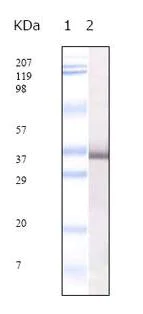 Western blot - Anti-SARS E2 antibody [4A6C9] - Coronavirus (AB31951)