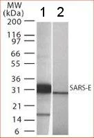 Western blot - Anti-SARS Envelope Protein antibody - Coronavirus (AB22055)