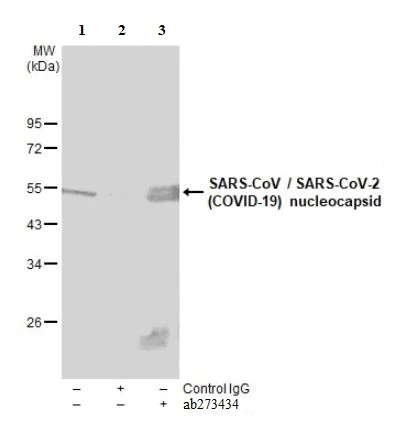Immunoprecipitation - Anti-SARS Nucleocapsid Protein antibody [6H3] (AB273434)