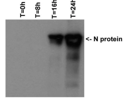 Western blot - Anti-SARS Nucleocapsid Protein antibody [6H3] (AB273434)