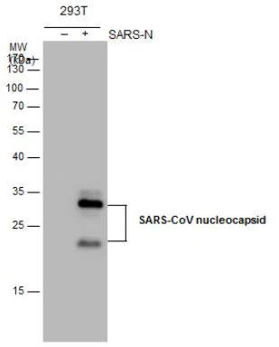 Western blot - Anti-SARS Nucleocapsid Protein antibody [6H3] (AB273434)