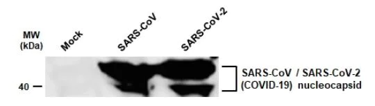 Western blot - Anti-SARS Nucleocapsid Protein antibody [6H3] (AB273434)