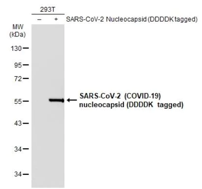 Western blot - Anti-SARS Nucleocapsid Protein antibody [6H3] (AB273434)