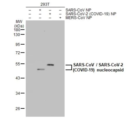 Western blot - Anti-SARS Nucleocapsid Protein antibody [6H3] (AB273434)