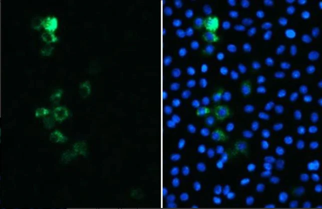 Immunocytochemistry/ Immunofluorescence - Anti-SARS spike glycoprotein antibody [1A9] (AB273433)