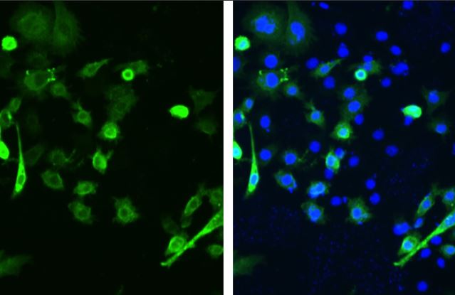 am⁂様 Anti-SARS spike glycoprotein antibody [1A9] (ab273433) | Abcam