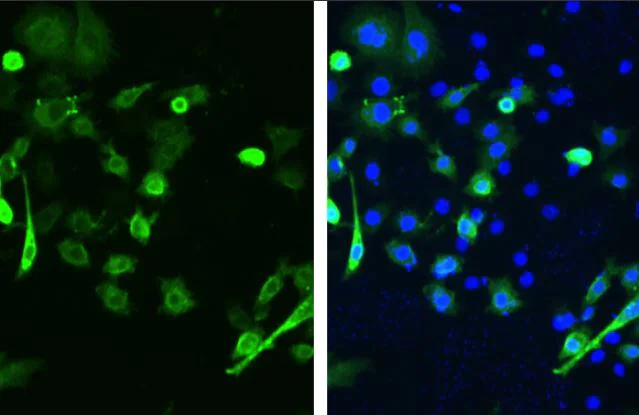 Immunocytochemistry/ Immunofluorescence - Anti-SARS spike glycoprotein antibody [1A9] (AB273433)
