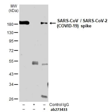 Immunoprecipitation - Anti-SARS spike glycoprotein antibody [1A9] (AB273433)