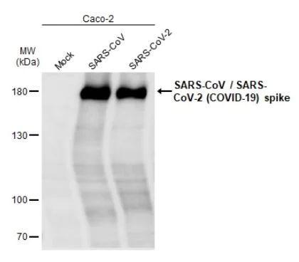 Western blot - Anti-SARS spike glycoprotein antibody [1A9] (AB273433)
