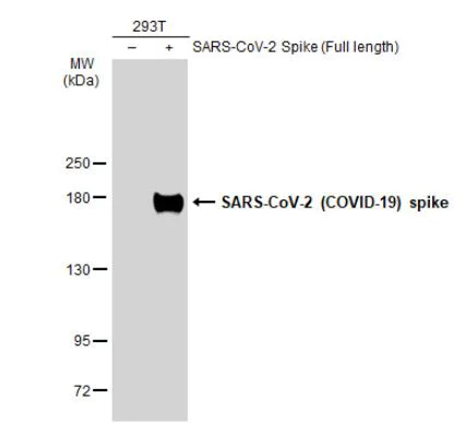 Western blot - Anti-SARS spike glycoprotein antibody [1A9] (AB273433)