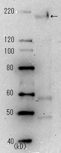 Western blot - Anti-SARS spike glycoprotein antibody [3A2] - Coronavirus (AB272420)