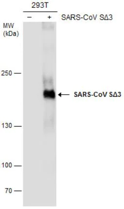 Western blot - Anti-SARS spike glycoprotein S1 antibody [7G12] (AB273436)
