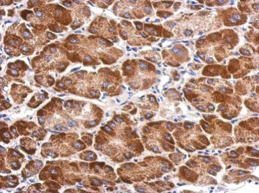 Immunohistochemistry (Formalin/PFA-fixed paraffin-embedded sections) - Anti-SARS2 antibody (AB229227)