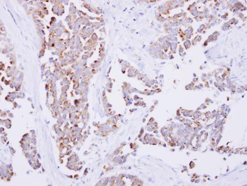 Immunohistochemistry (Formalin/PFA-fixed paraffin-embedded sections) - Anti-SARS2 antibody (AB229227), expandable thumbnail