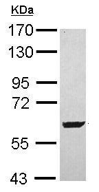 Western blot - Anti-SARS2 antibody (AB229227), expandable thumbnail