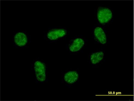 Immunocytochemistry/ Immunofluorescence - Anti-SART1 antibody (AB88583), expandable thumbnail
