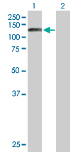 Western blot - Anti-SART1 antibody (AB88583), expandable thumbnail