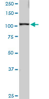 Western blot - Anti-SART1 antibody (AB88583), expandable thumbnail