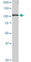 Western blot - Anti-SART1 antibody (AB88583)