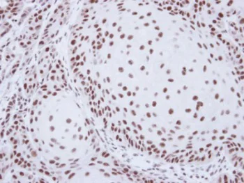 Immunohistochemistry (Formalin/PFA-fixed paraffin-embedded sections) - Anti-SART1 antibody (AB95957)