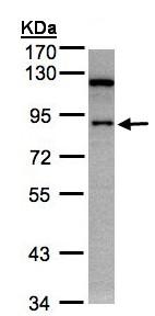 Western blot - Anti-SART1 antibody (AB95957)