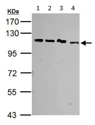 Western blot - Anti-SART1 antibody (AB95957)