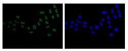 Immunocytochemistry/ Immunofluorescence - Anti-SART1 antibody [EPR14563(B)] (AB181867)