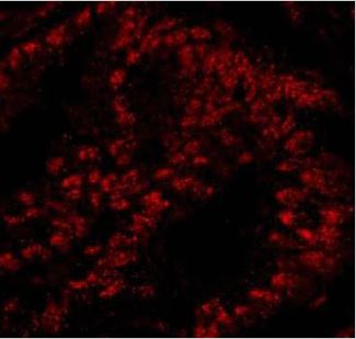 Immunohistochemistry (Frozen sections) - Anti-SART3 antibody (AB176822)